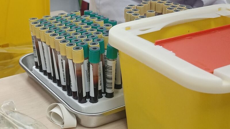 O remédio que faz o Parkinson andar pode estar drenando uma vitamina — e ninguém dosava