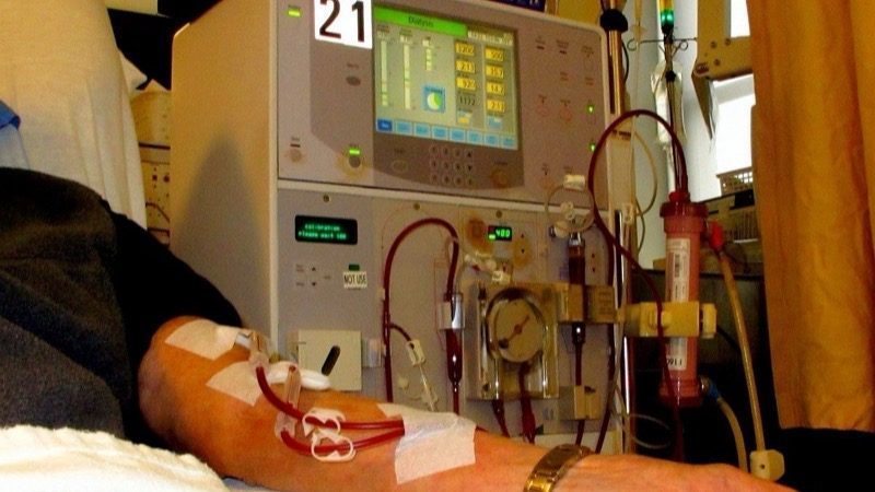 Um rim de porco segurou um paciente por nove meses até chegar o rim humano